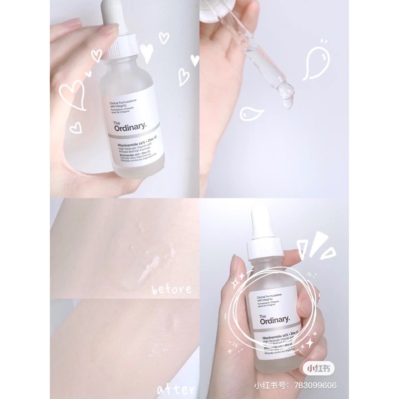 TINH CHẤT GIẢM THÂM MỤN THE ORDINARY NIACINAMIDE 10% + ZINC 1%