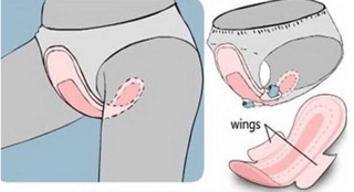 Giá dùng thử:5 miếng BVS Việt Ý