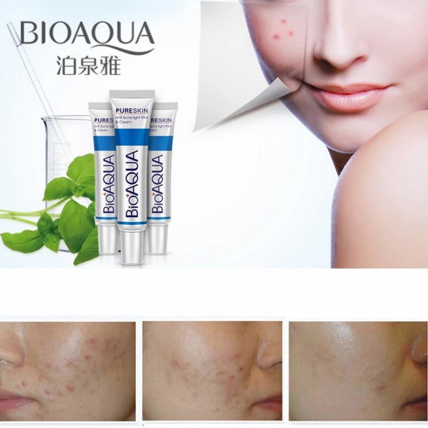 Kem Hỗ Trợ Giảm Mụn Bioaqua Chăm Sóc Da Kiềm Dầu Và Thu Nhỏ Lỗ Chân Lông | BigBuy360 - bigbuy360.vn