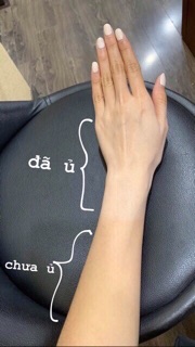 Ủ TRẮNG PHA LÊ TINH THỂ NƯỚC ACOMETIC