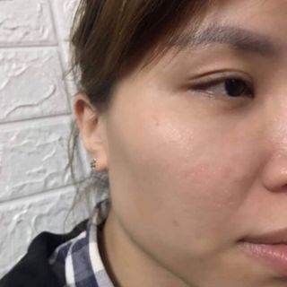 SÉT NHỎ PEEL TCA USA