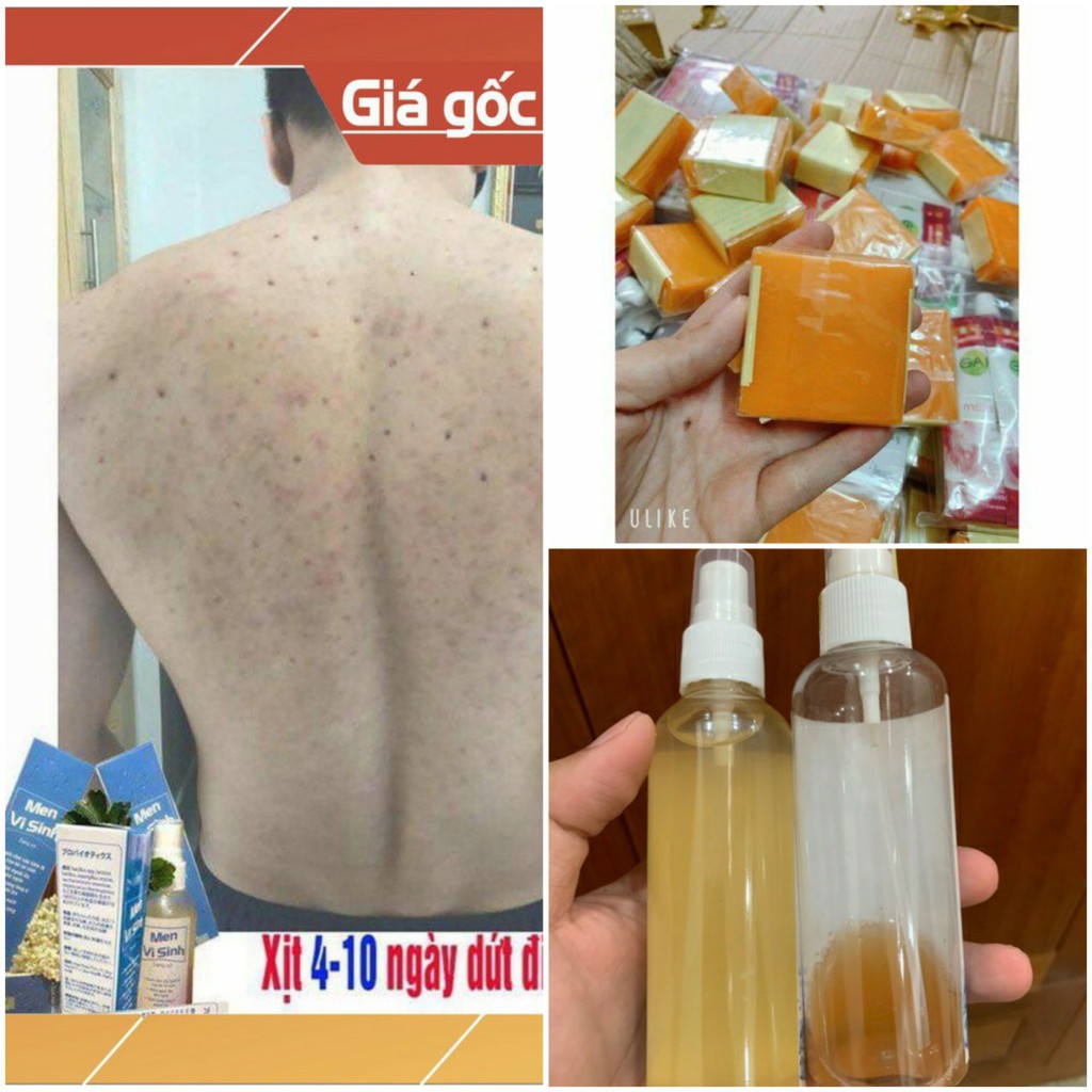SOAP NGHỆ THÁI LAN HỖ TRỢ GIẢM MỤN THÂM VÀ VIÊM NANG LÔNG | BigBuy360 - bigbuy360.vn