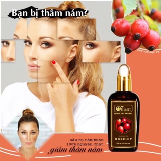 Dầu Nụ tầm xuân nguyên chất 100ml