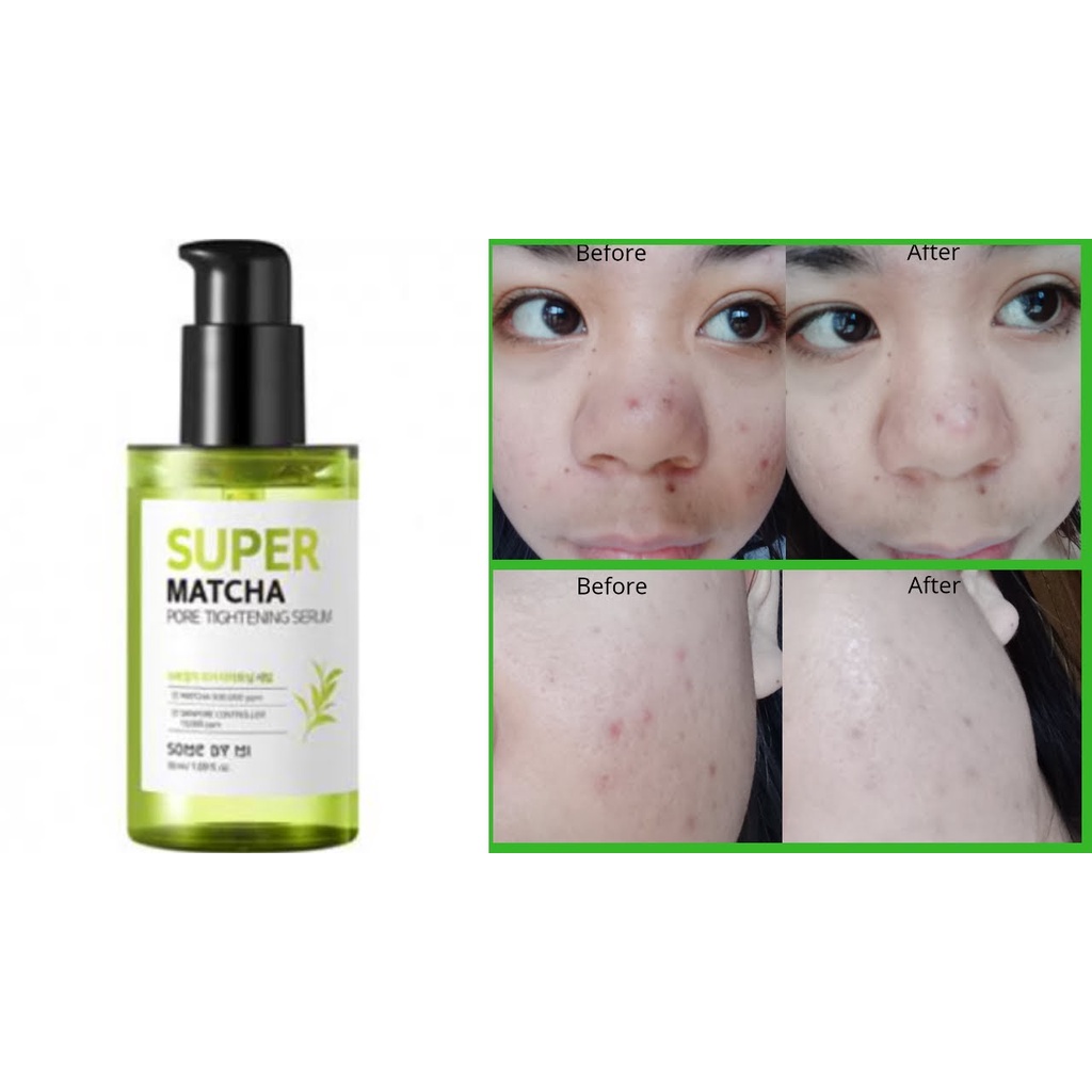 Tinh Chất Trà Xanh SOMEBYMI Super Matcha Pore Tightning Serum 50ml