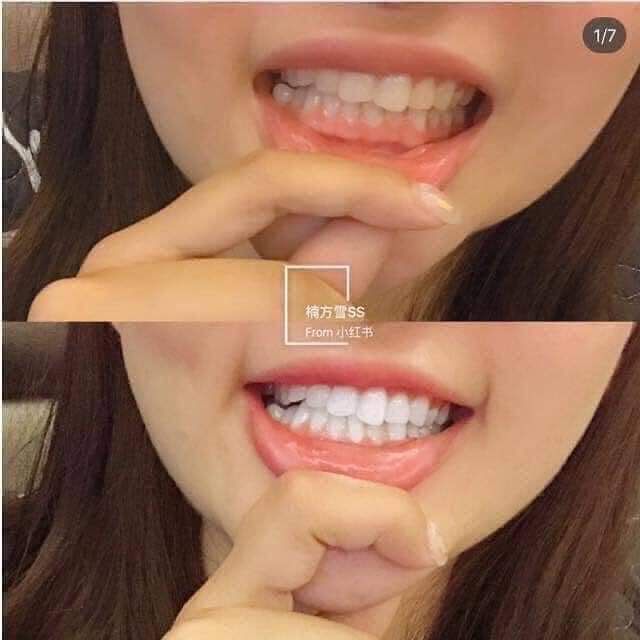 Kem Đánh Răng Median White Dental IO Toothpaste 93% Hàn Quốc chính hãng 120gr
