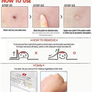 MIẾNG DÁN HÚT MỤN COSRX ACNE PIMPLE MASTER PATCH