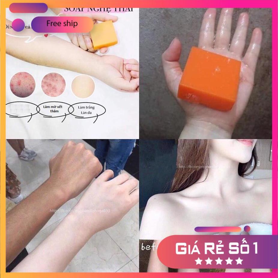 Xà Phòng Nghệ Cam Galong Thái Lan Trắng Da Mụn Thâm 65gr | BigBuy360 - bigbuy360.vn
