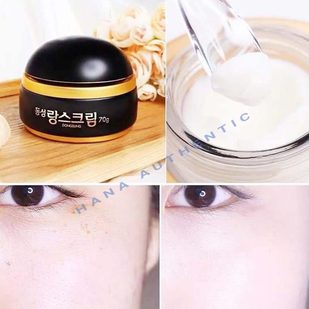 [FREESHIP] Kem hỗ trợ trị nám Dongsung Rannce Cream