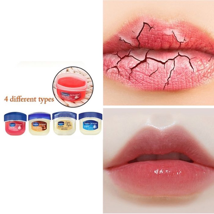 Vaseline Dưỡng Môi Vaseline Lip Therapy 7G Chính Hãng