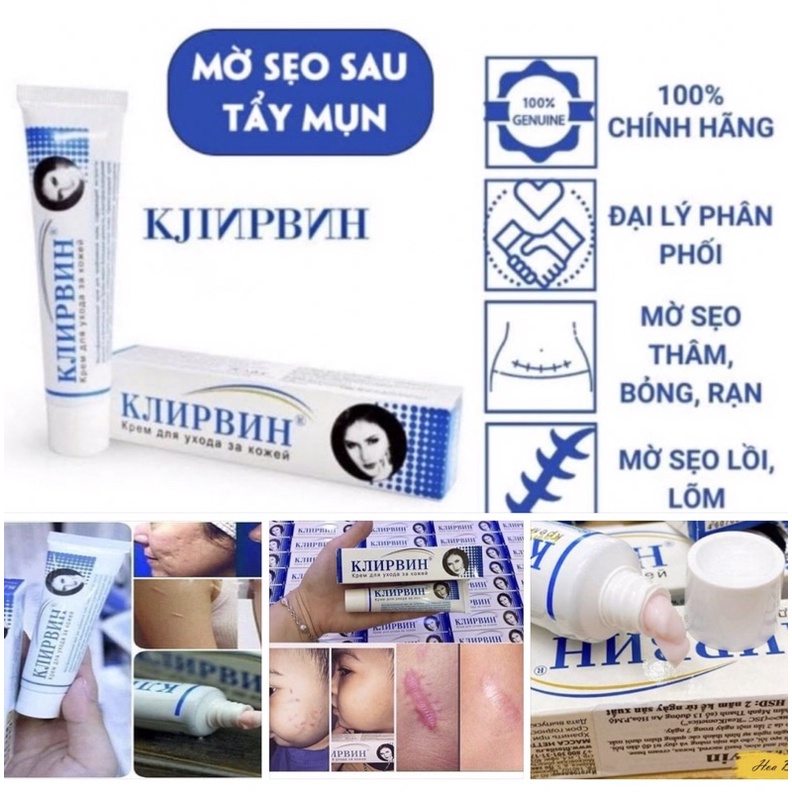 Kem sẹo Nga klirvin_ hàng chuẩn Nga
