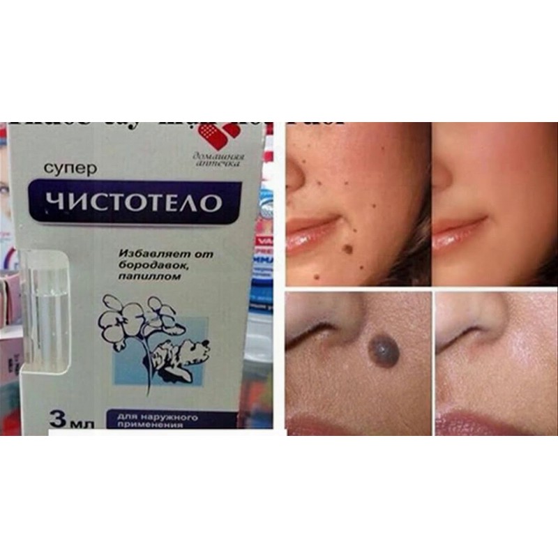 ✔️[100% Chính Hãng] Kem Tẩy Nốt Ruồi Dvelinil Nga_Tẩy Nốt Ruồi, Tẩy Mụn Cóc, Tẩy Mụn Thịt Khô An Toàn | BigBuy360 - bigbuy360.vn