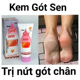 Kem trị nứt gót chân, mềm da chân Gót Sen
