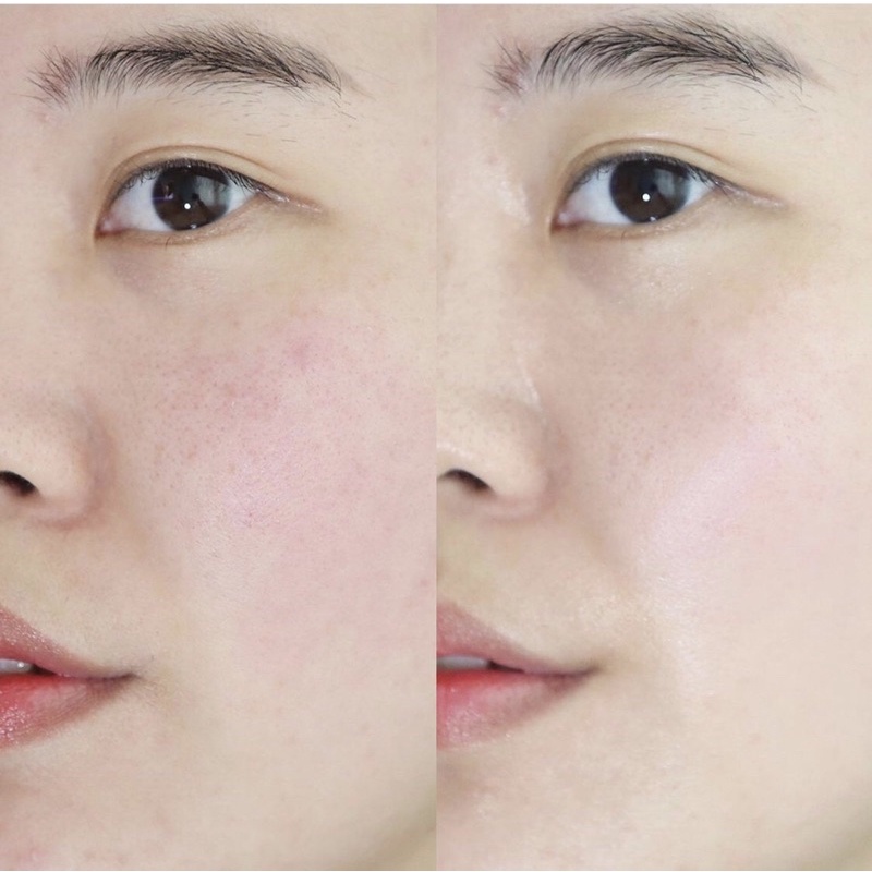 Tinh chất Ildong làm sáng da, chống lão hoá Probiotic Serum 50ml