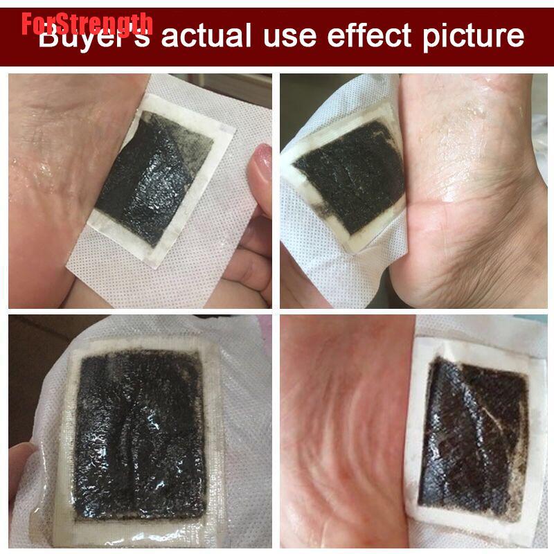 (hàng Mới Về) Set 25 Miếng Dán Gừng Thải Độc Chân Thư Giãn Cơ Thể | BigBuy360 - bigbuy360.vn