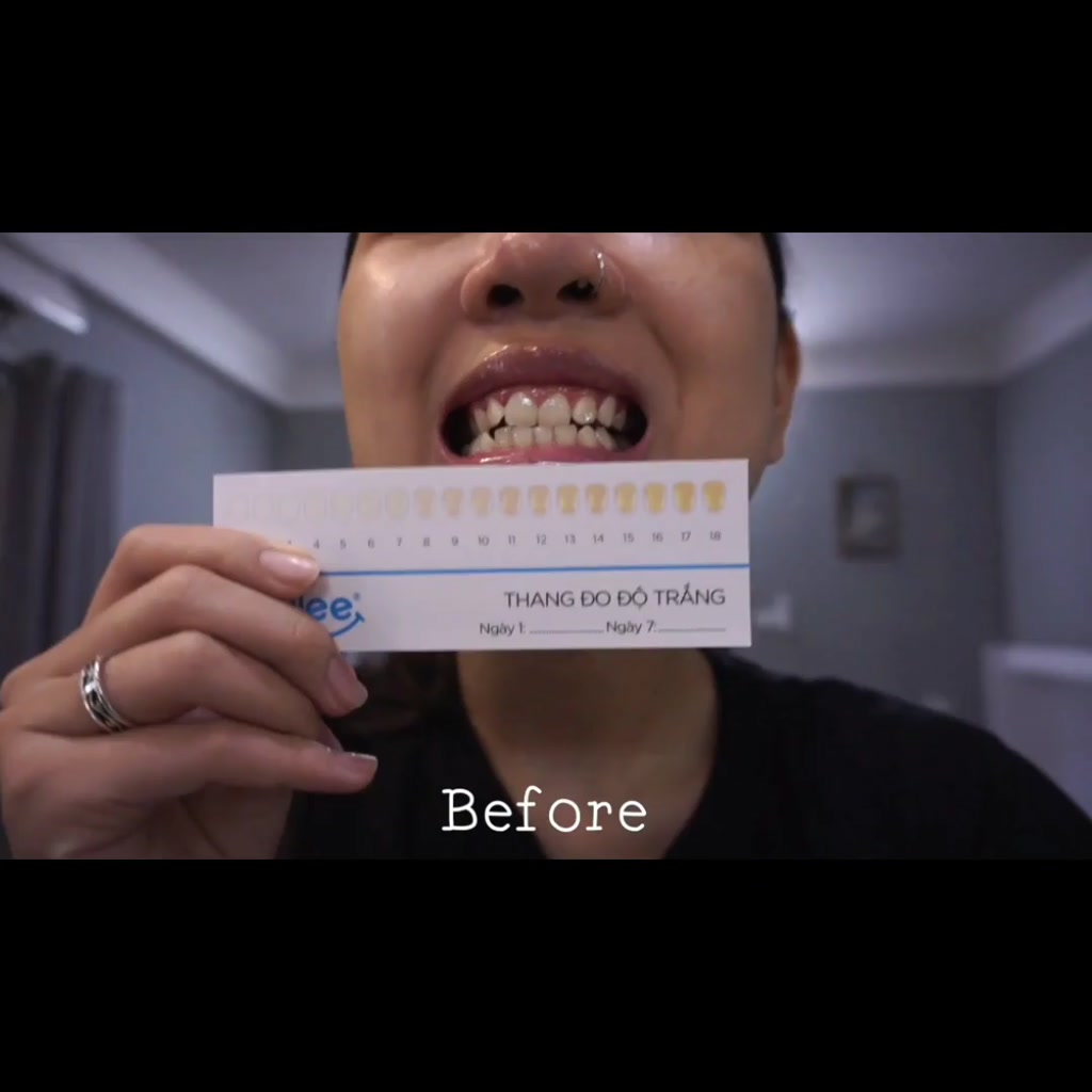 [GIÁ 438K TẠI LIVE SHOP] Trắng răng Smilee Max, bộ kit làm trắng răng từ 2 đến 6 tone sau 1 liệu trình an toàn răng nướu | BigBuy360 - bigbuy360.vn