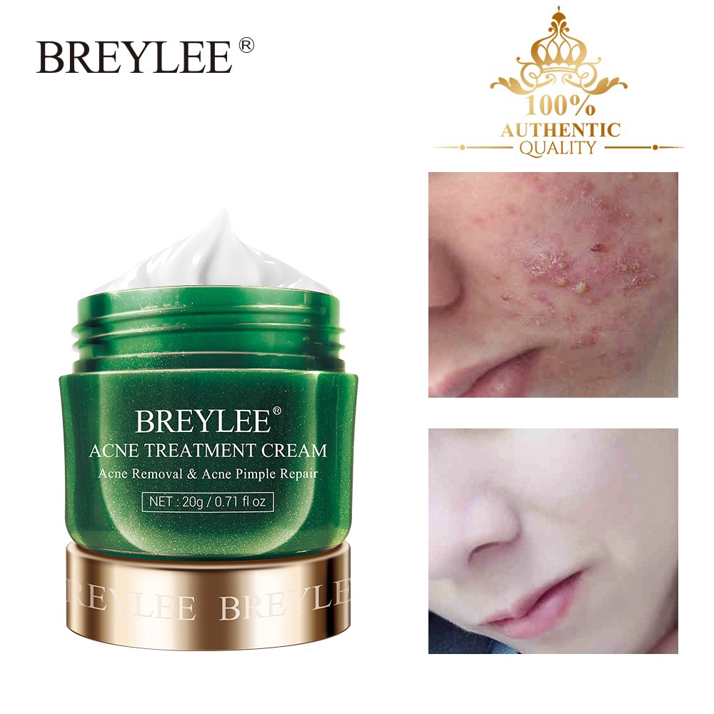 Kem Hỗ Trợ Giảm Pimples Breylee Kiềm Dầu Thu Nhỏ Lỗ Chân Lông 20g / 0.71 floz