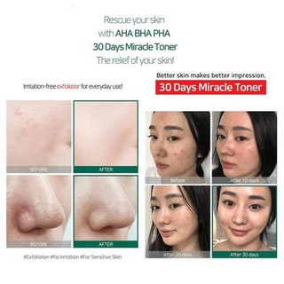 💥 Toner AHA – BHA – PHA 30 Days Miracle Toner