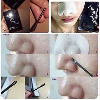 Mặt nạ good bye blackhead ciracle