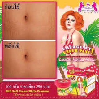 kem trị rạn bụng , đùi OHO Thái lan