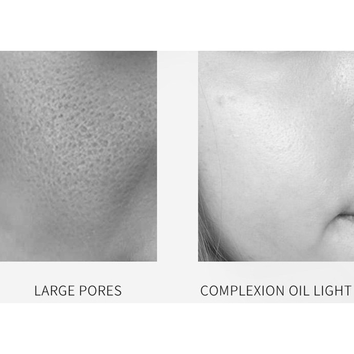 Tinh Chất Serum Thu Nhỏ Lỗ Chân Lông VENZEN Dưỡng Ẩm Và Làm Trắng Sáng Da Mặt MS6062