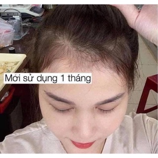 Xịt mọc tóc bưởi xanh chai 100ml