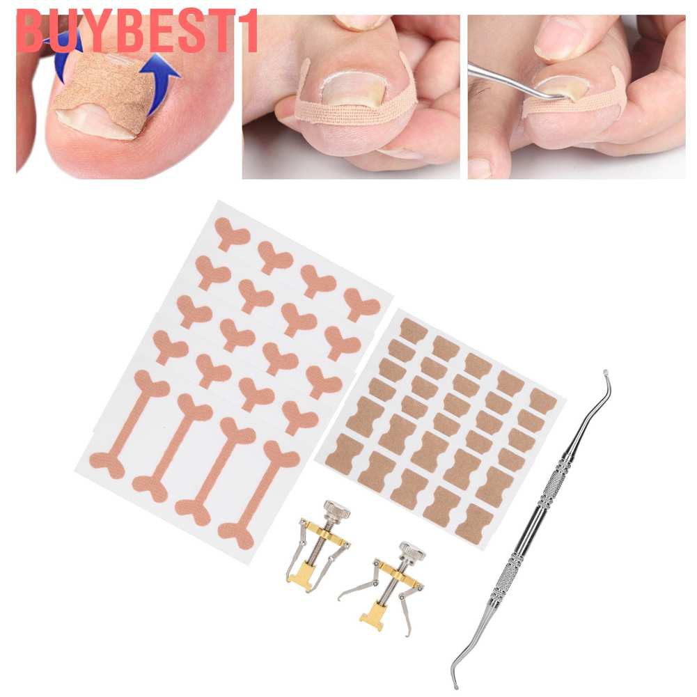 (Hàng Mới Về) Set 13 Miếng Dán Chỉnh Hình Móng Chân Tiện Dụng | BigBuy360 - bigbuy360.vn