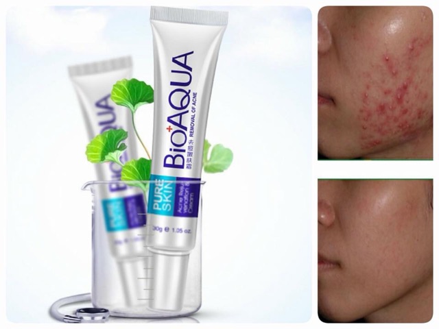 Kem Ngừa Mụn Pure Skin Bioaqua | BigBuy360 - bigbuy360.vn