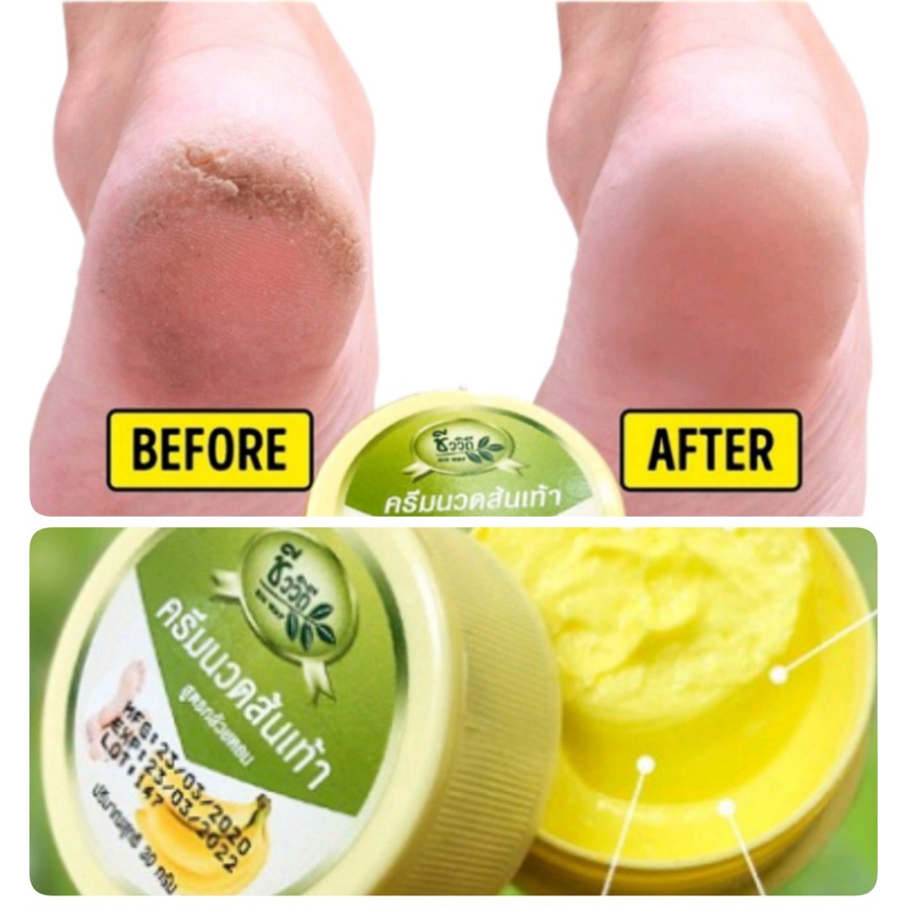 Chính hãng Thái - Kem Giảm Nứt Gót Chân BANANA HEEL CREAM 30g Thái Lan - LQC18