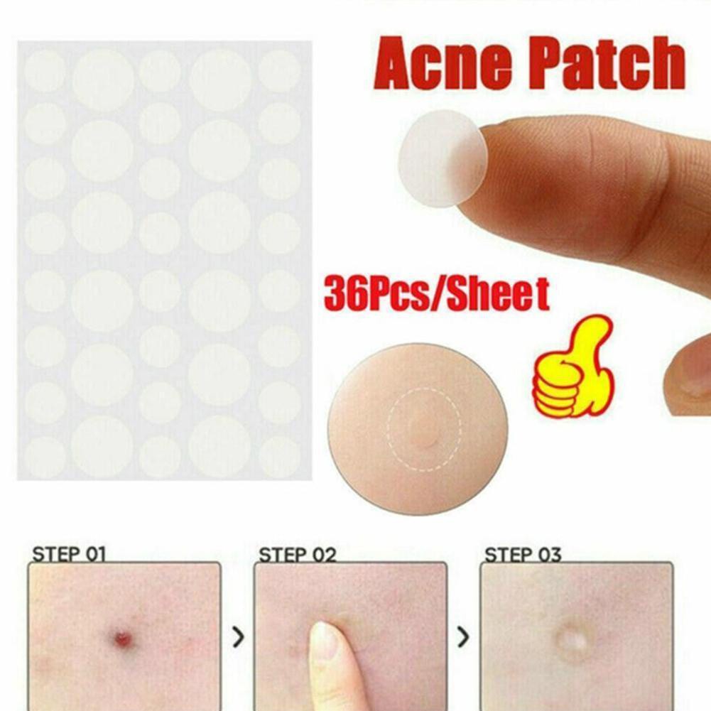 Combo 36 miếng dán mụn, hiệu quả xẹp mụn nhanh | BigBuy360 - bigbuy360.vn