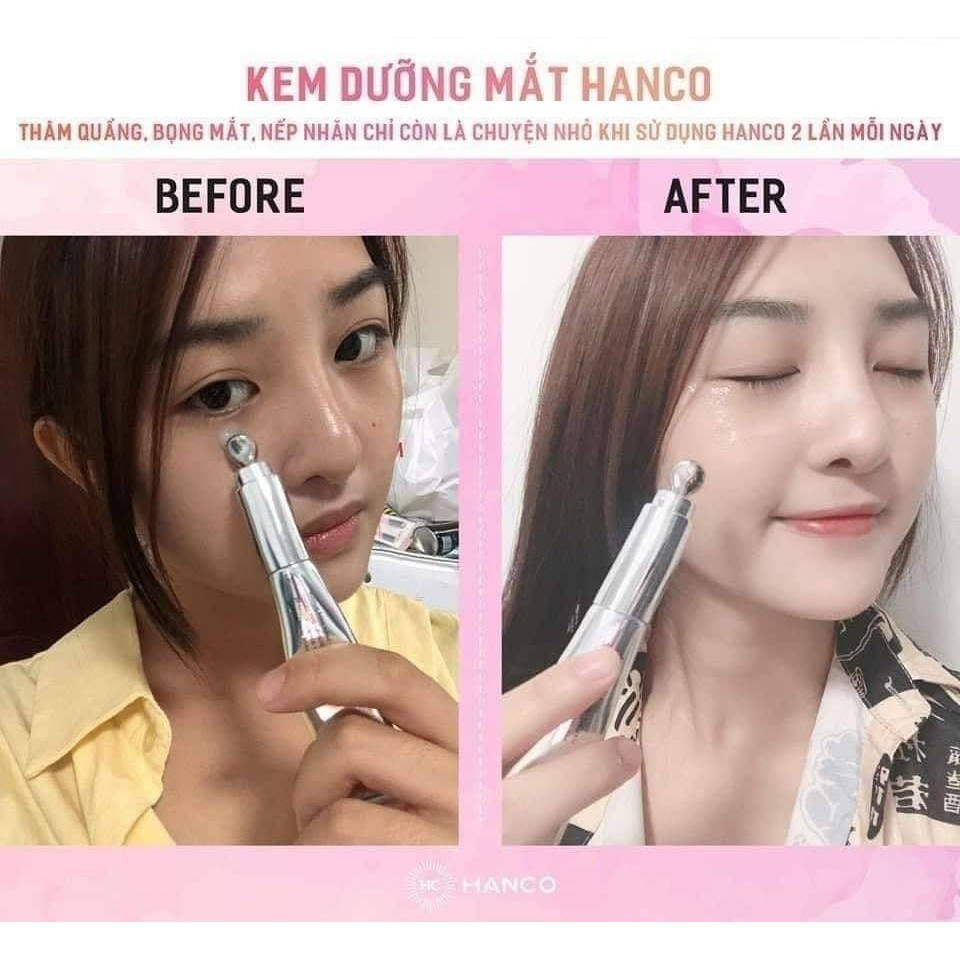 KEM DƯỠNG MẮT HANCO CHÍNH HÃNG - NGƯỜI BẠN ĐỒNG HÀNH KHÔNG THỂ THIẾU CỦA PHÁI ĐẸP - 7878