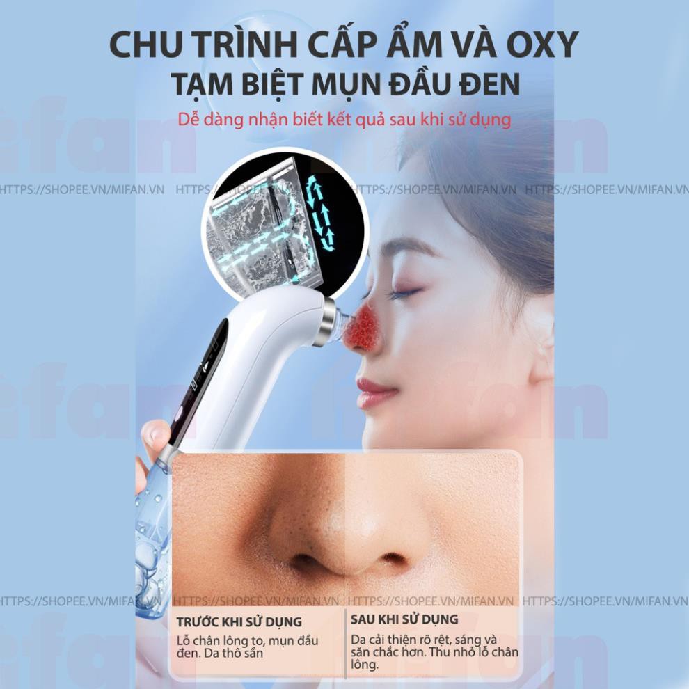 Máy Hút Mụn Đa Năng Thế Hệ Mới - Hút Mụn Đầu Đen, Mụn Cám, Rửa Mặt, Làm Sạch Lỗ Chân Lông, Phun Oxy Dưỡng Ẩm Sáng Mịn Da