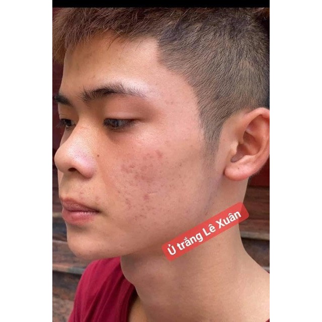 Ủ Trắng Face Nhuỵ Hoa Nghệ Tây Lê Xuân | BigBuy360 - bigbuy360.vn