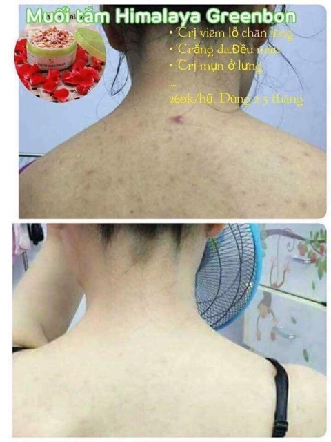 Muối tắm khoáng Himalaya của Greenbon | BigBuy360 - bigbuy360.vn