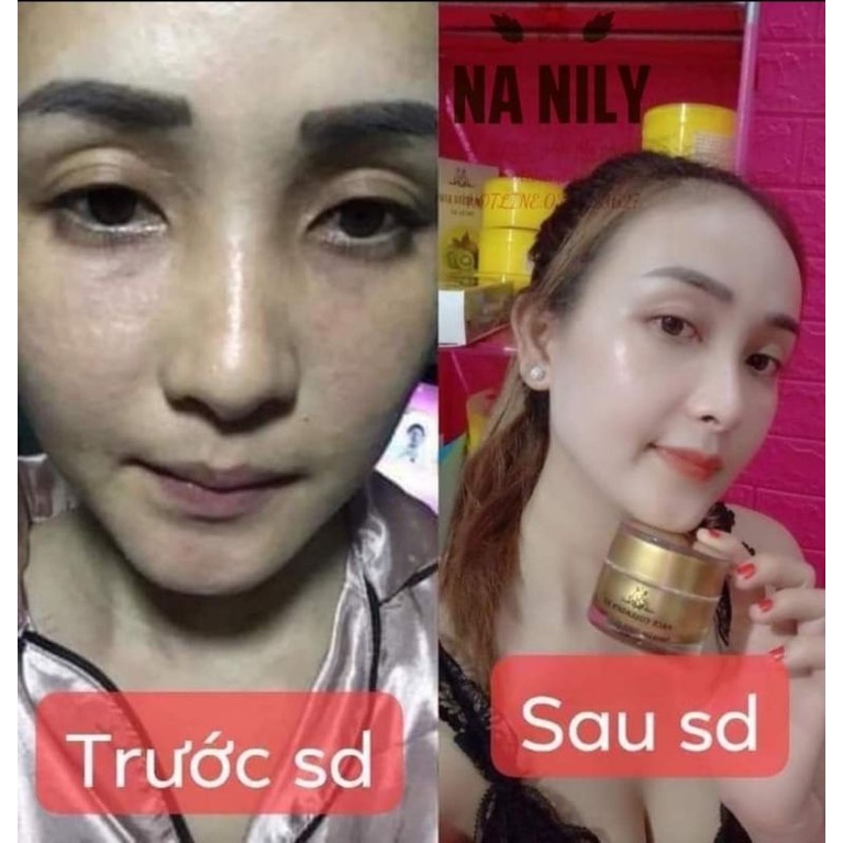FACE COLLAGEN DƯỠNG TRẮNG DA MP ĐÔNG ANH CHÍNH HÃNG | BigBuy360 - bigbuy360.vn