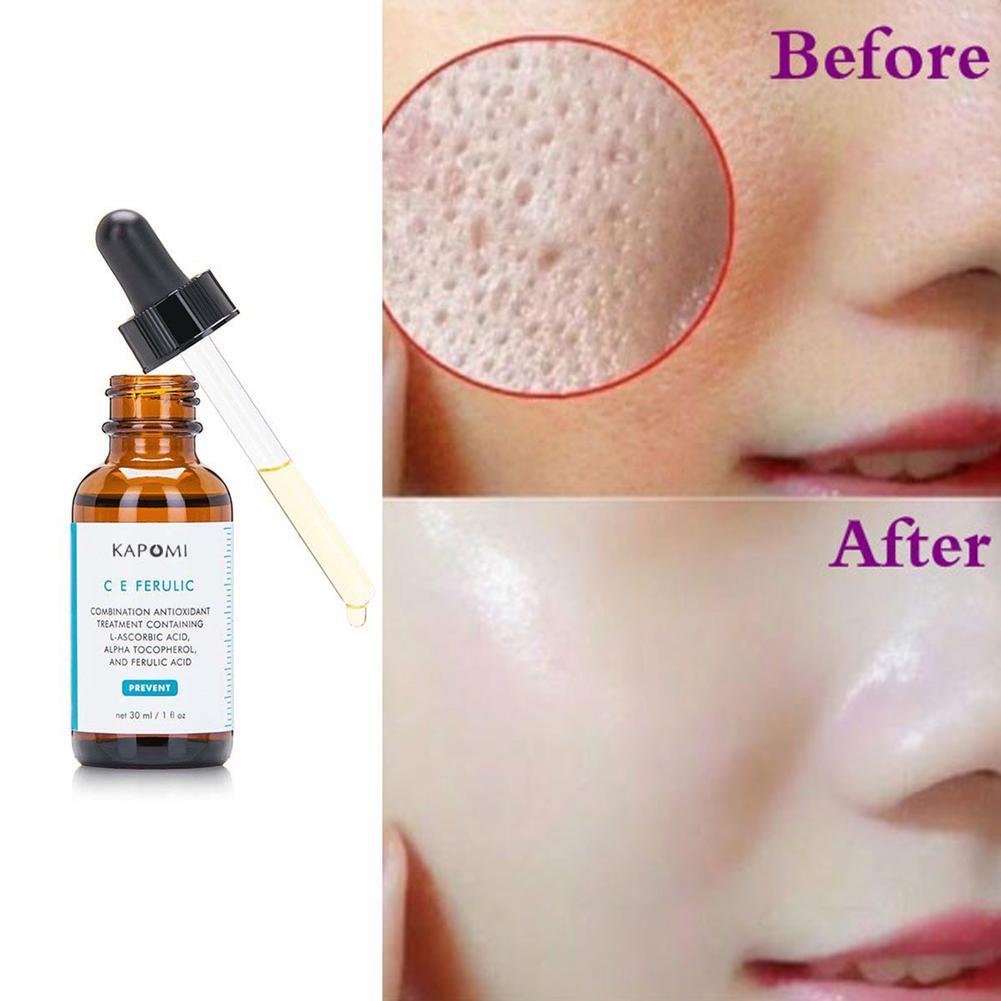 (Hàng Mới Về) Tinh Chất Vitamin Chống Oxy Hóa Phục Hồi Da Chất Lượng Cao 30ml H4G1