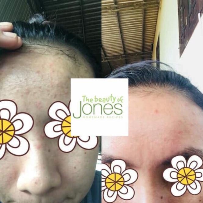 Toner hoa cúc dành cho mẹ bầu The Beauty of Jones 100gr2022 | BigBuy360 - bigbuy360.vn