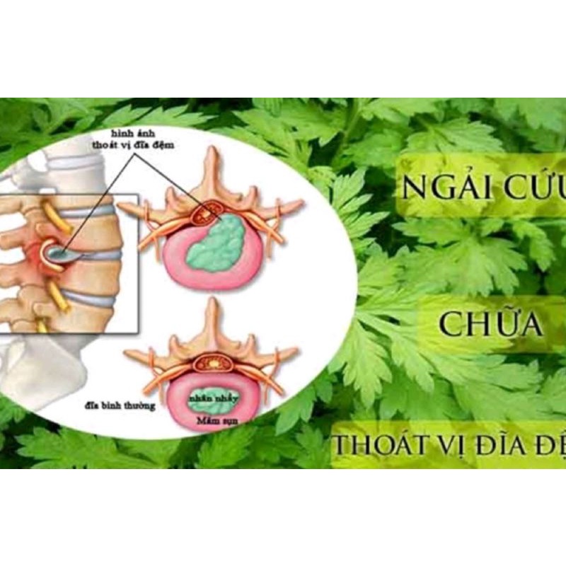 60 Cây Ngải Cứu giống
