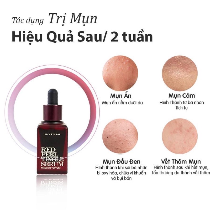 Tinh chất redpeel premium chính hãng So Natural Hàn Quốc 20ml dành cho da Châu Á.