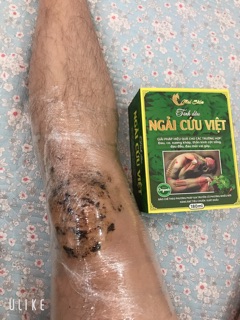 TINH DẦU NGẢI CỨU VIỆT