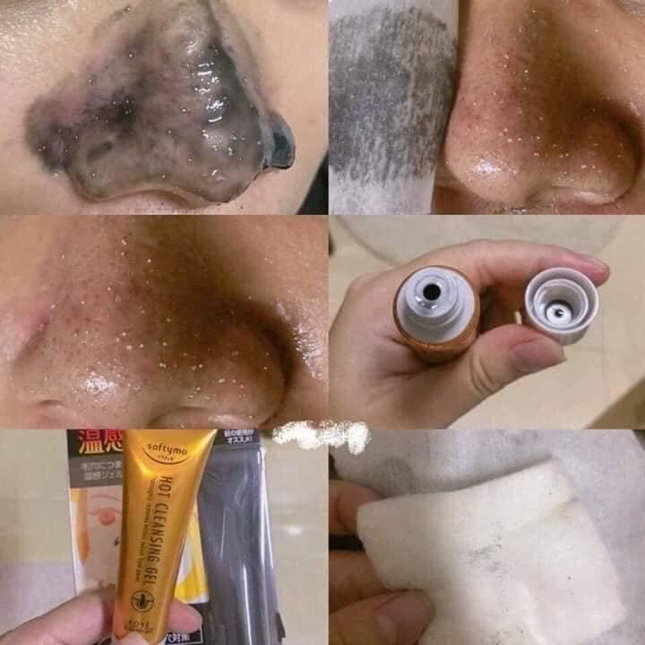 GEL LỘT MỤN KOSE HOT CLEANSING GEL cao cấp