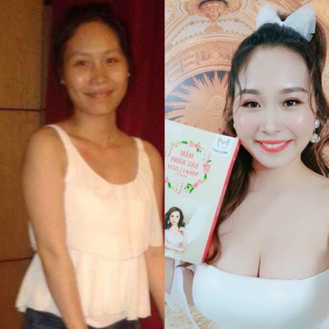 {Chính hãng Mua 1 tặng 2} COMBO 3 MẦM ĐẬU NÀNH TĂNG VÒNG 1 MINH LADY BEAUYTY (tặng 1 tinh dầu matxa tăng V1 + 1 kẹo mầm)