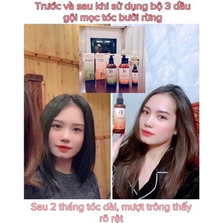 Bộ sản phẩm chăm sóc tóc Bưởi Rừng TB.D’aboard