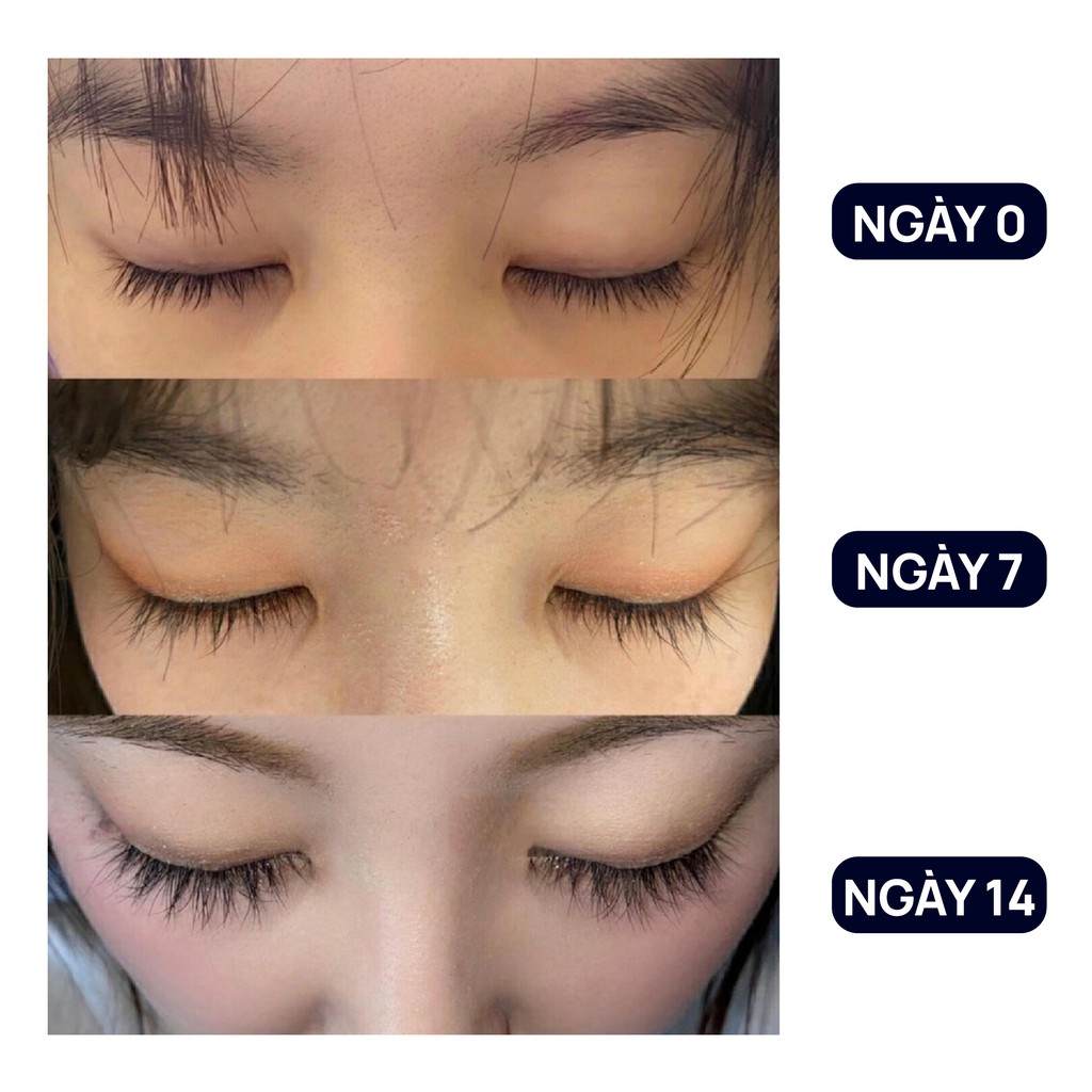 Dưỡng mi FEG Plus+ Eyelash Vitalizer_Serum Dưỡng mi FEG plus Dưỡng mi - Giúp Mi mọc nhanh và dài