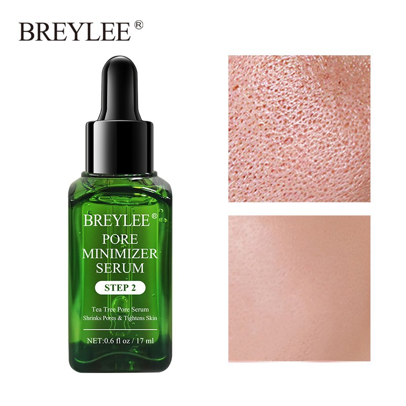 (Hàng Mới Về) Serum Trị Mụn Đầu Đen Thu Nhỏ Lỗ Chân Lông Breylee 17ml | BigBuy360 - bigbuy360.vn