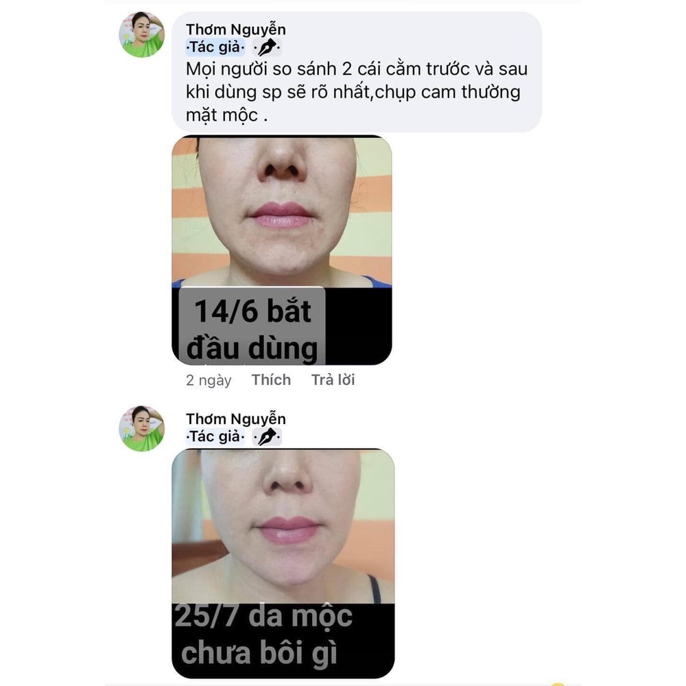 Kem Retinal 1% Lumiderm Retinal Advanced - A 1.0 Cream