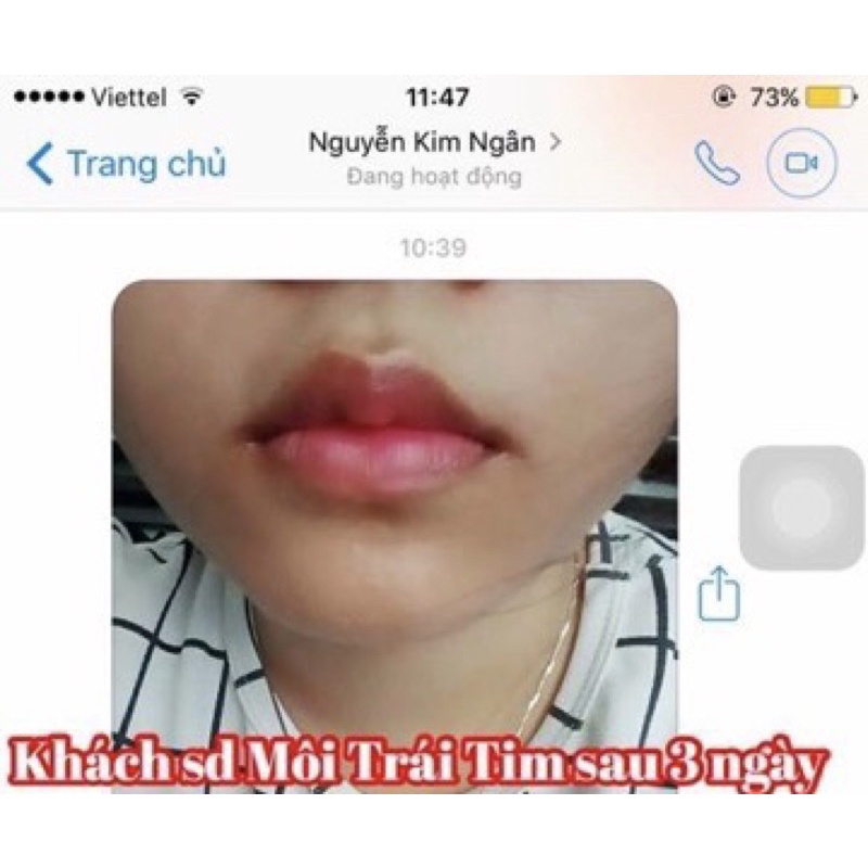 Tinh chất Miracle Pháp tạo môi trái tim và làm dầy môi sexy (10ml)