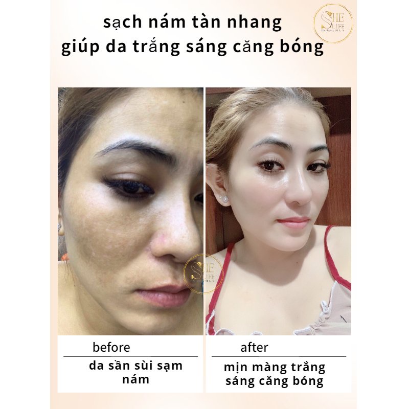 Kem Hạ Gục Nám Tàn Nhang She Life 20gr Ban Đêm, Serum Collagen Tươi Dưỡng Da Cao Cấp She Life 20ml