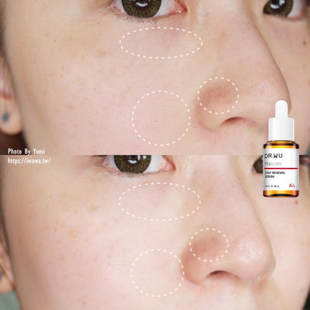 Serum Dr wu Mandelic Acid