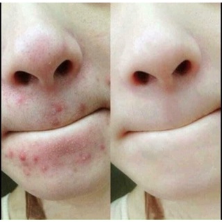 SERUM RAU MÁ CENTELLA SKIN1004 55ML