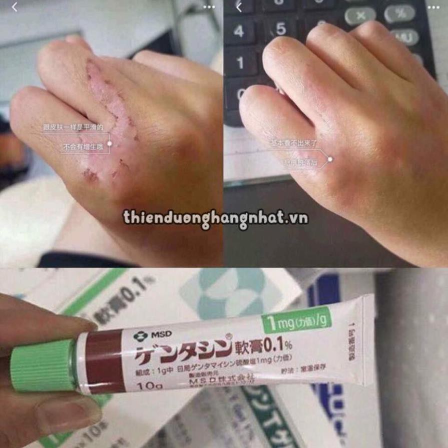 Kem giảm sẹo Gentacin Nhật Bản 10g shiroba